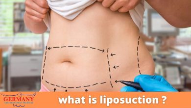 Photo of What is Liposuction?