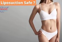 Photo of Is Liposuction Safe?