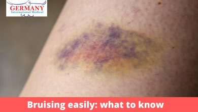 Photo of Bruising easily: what to know